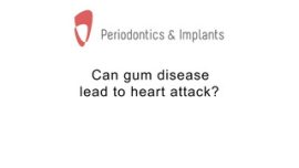 Can gum disease lead to heart attack?