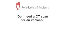 Do I need a CT scan for an implant?