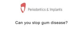 Can you stop gum disease?